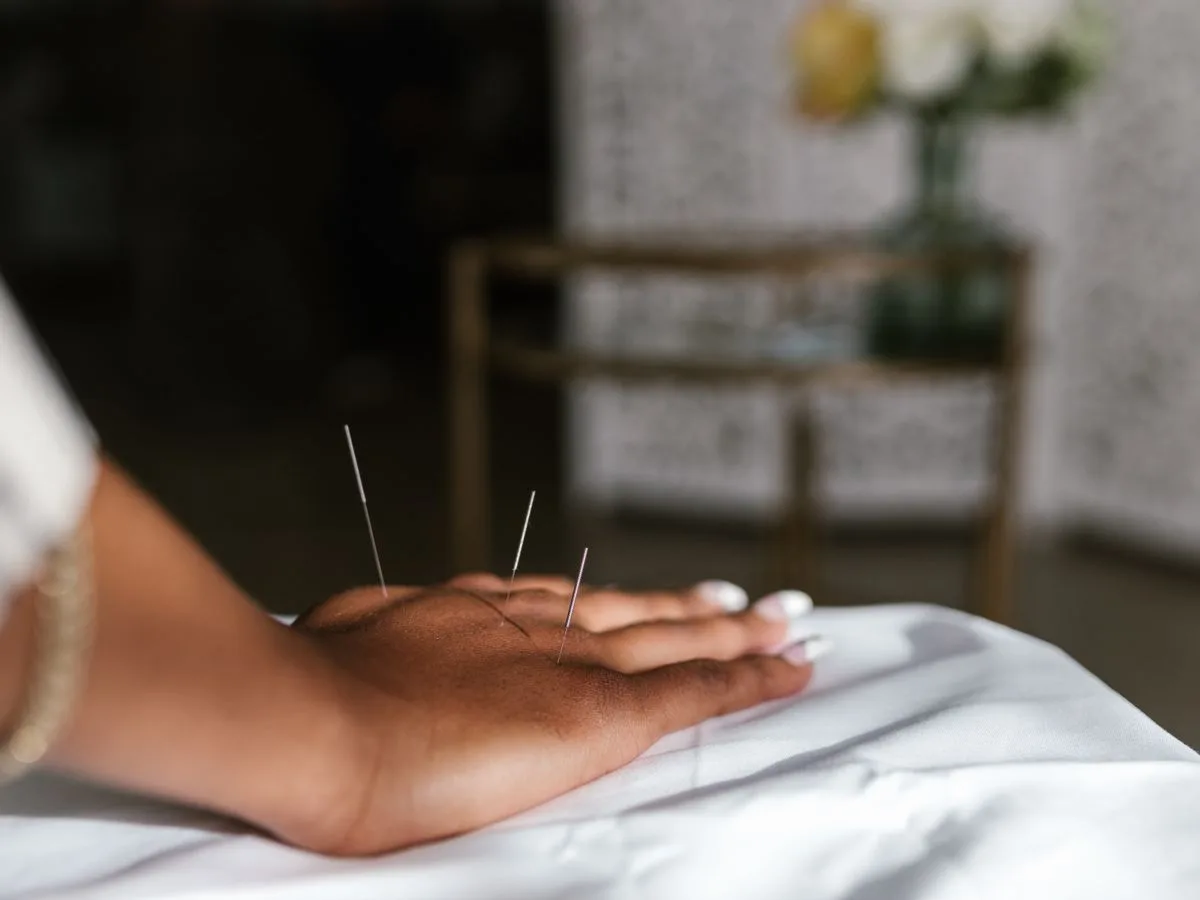 Sujok therapy points on hand during naturopathy treatment in Haridwar